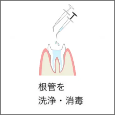 レントゲンやCTを撮り、虫歯部分を削る