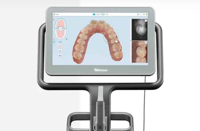 口腔内スキャナー　iTero（アイテロ）