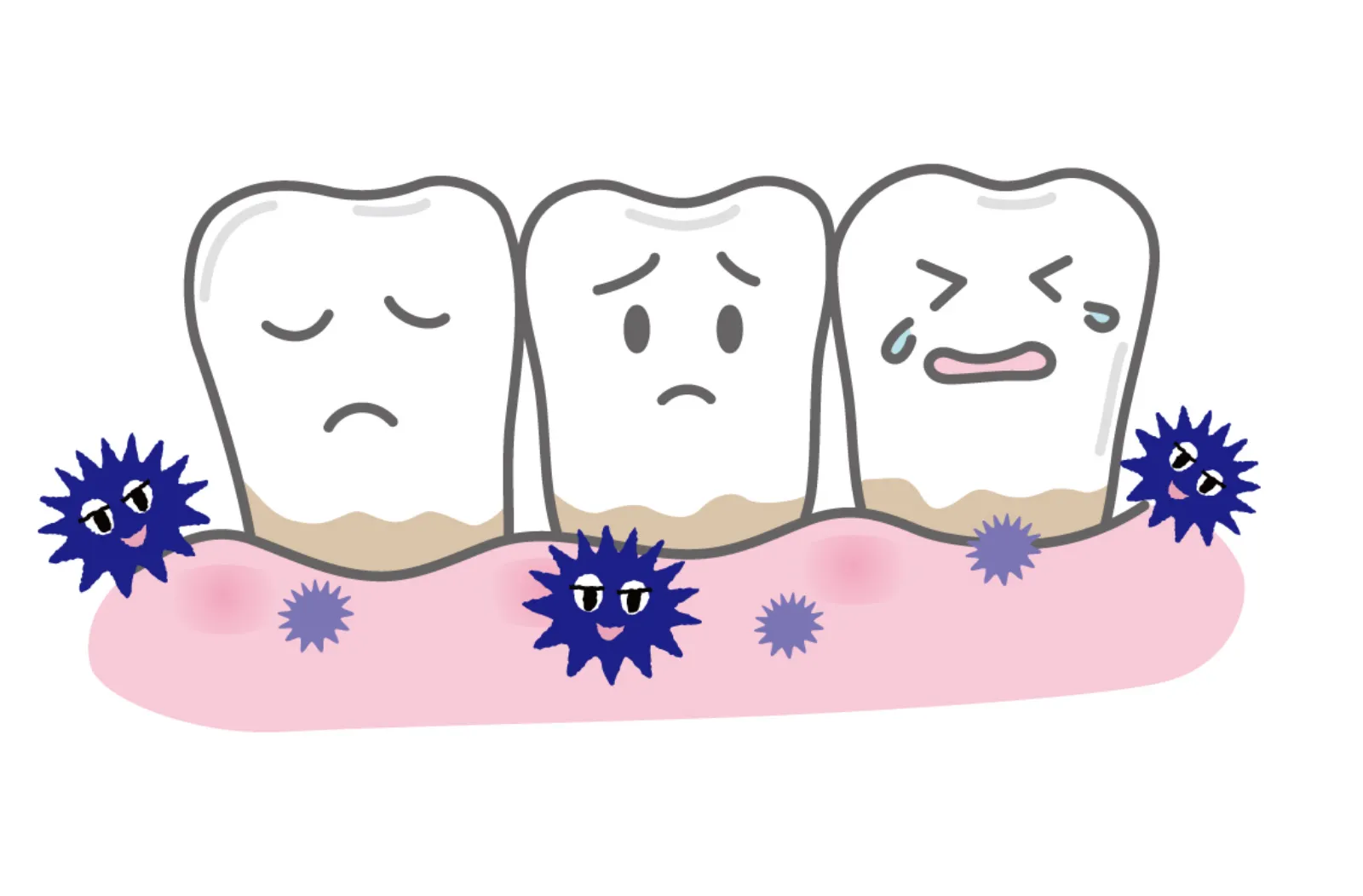 歯が抜ける原因の約半分は歯周病