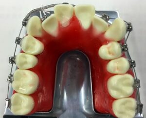 矯正咬合セミナー参加3