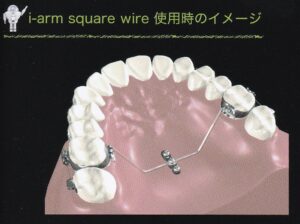 インプラント矯正の新しい潮流
